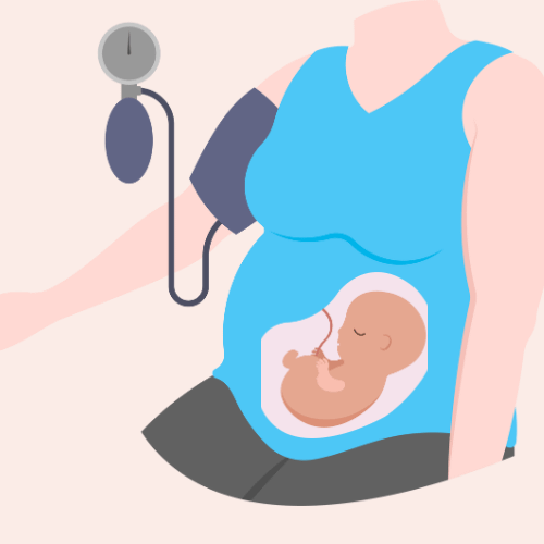 Hipertensión Gestacional causas tratamiento fisioterapia